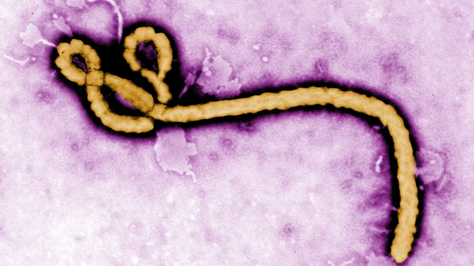 Ebola death toll in DRC hits 600, WHO reports